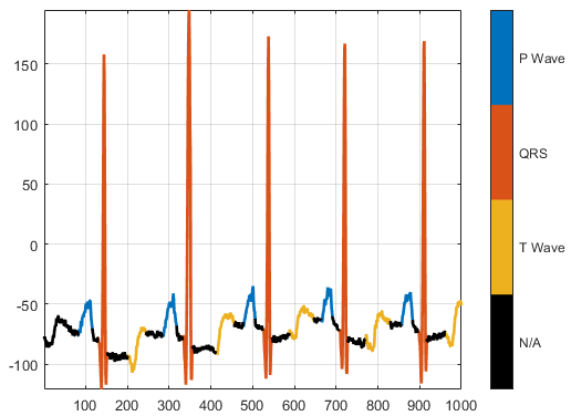 Segmented electrocardiogram with different colors showing which parts of the signal are P Wave, QRS, T Wave, or unclassified