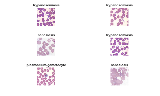 Figure contains 6 axes objects. Hidden axes object 1 with title trypanosomiasis contains an object of type image. Hidden axes object 2 with title trypanosomiasis contains an object of type image. Hidden axes object 3 with title babesiosis contains an object of type image. Hidden axes object 4 with title trypanosomiasis contains an object of type image. Hidden axes object 5 with title plasmodium-gametocyte contains an object of type image. Hidden axes object 6 with title babesiosis contains an object of type image.