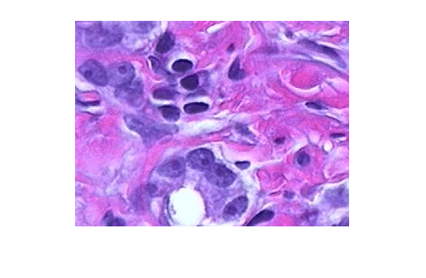 Figure contains an axes object. The hidden axes object contains an object of type image.