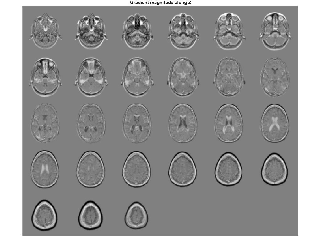 Figure contains an axes object. The hidden axes object with title Gradient magnitude along Z contains an object of type image.