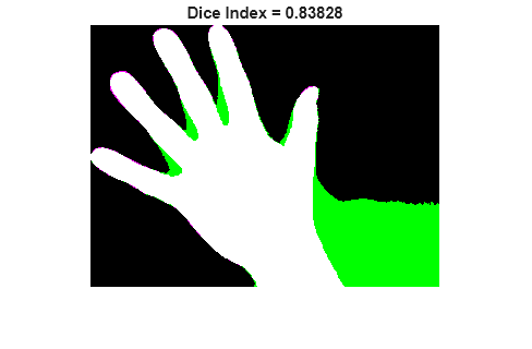 Figure contains an axes object. The hidden axes object with title Dice Index = 0.83828 contains an object of type image.