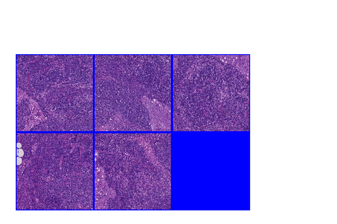 Figure contains an axes object. The hidden axes object contains an object of type image.