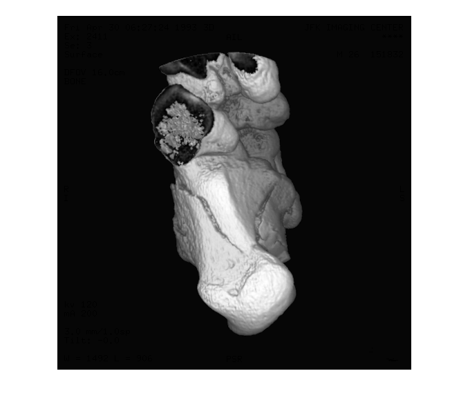 Figure contains an axes object. The hidden axes object contains an object of type image.