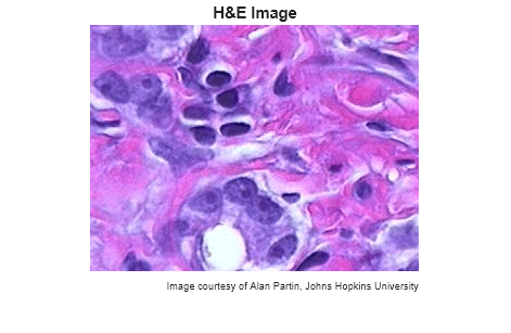 Figure contains an axes object. The hidden axes object with title H&E Image contains 2 objects of type image, text.