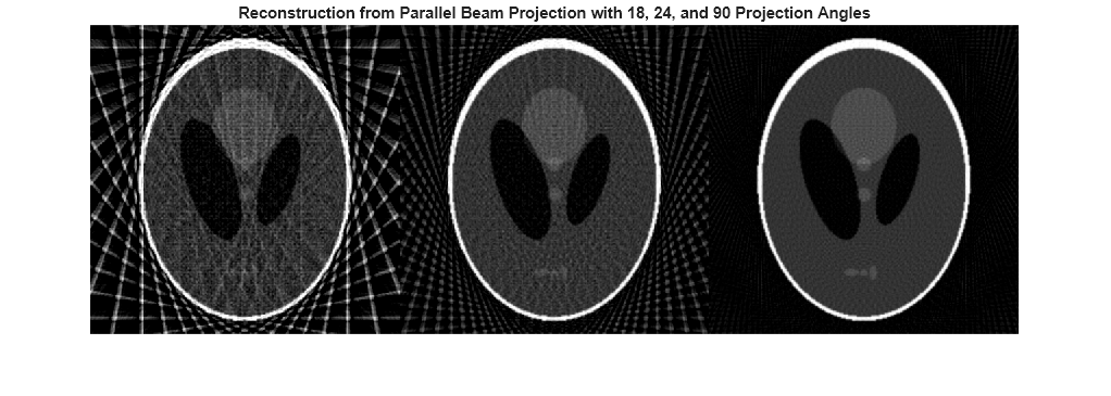 Figure contains an axes object. The hidden axes object with title Reconstruction from Parallel Beam Projection with 18, 24, and 90 Projection Angles contains an object of type image.