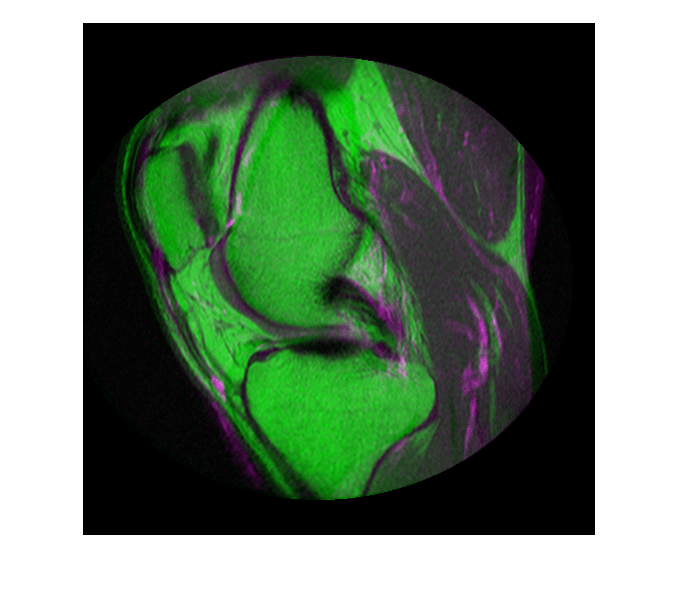 Figure contains an axes object. The hidden axes object contains an object of type image.