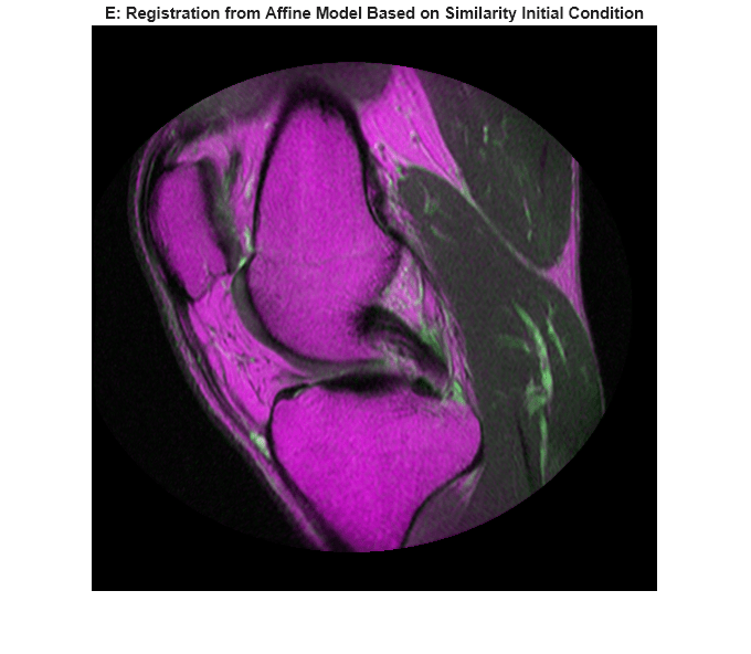 Figure contains an axes object. The hidden axes object with title E: Registration from Affine Model Based on Similarity Initial Condition contains an object of type image.