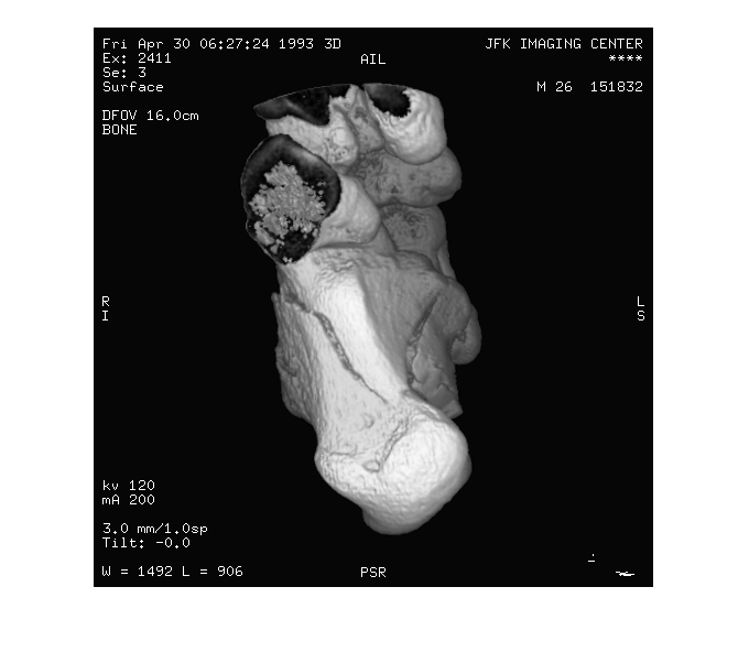 Figure contains an axes object. The hidden axes object contains an object of type image.