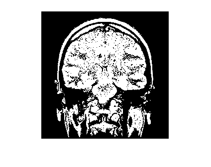 Figure contains an axes object. The hidden axes object contains an object of type image.