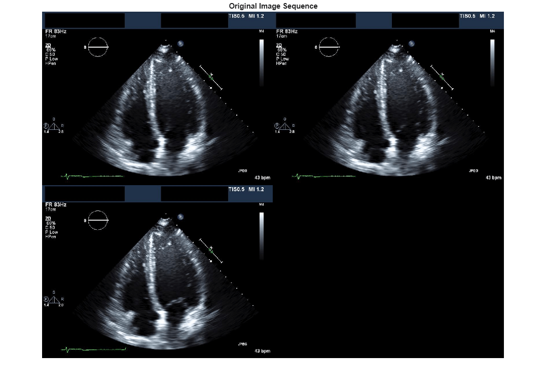 Figure contains an axes object. The hidden axes object with title Original Image Sequence contains an object of type image.