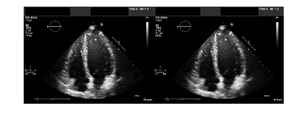 Figure contains an axes object. The hidden axes object contains an object of type image.