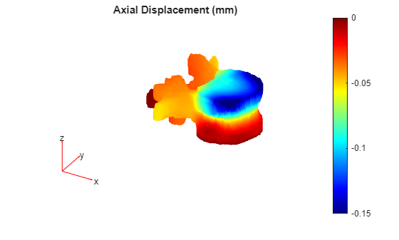 Figure contains an axes object. The hidden axes object with title Axial Displacement (mm) contains 5 objects of type patch, quiver, text.