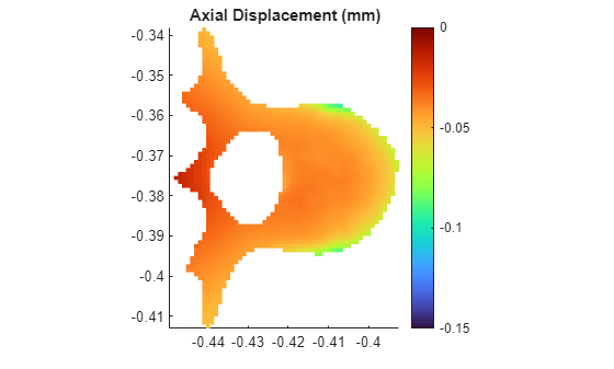 Figure contains an axes object. The axes object with title Axial Displacement (mm) contains an object of type surface.