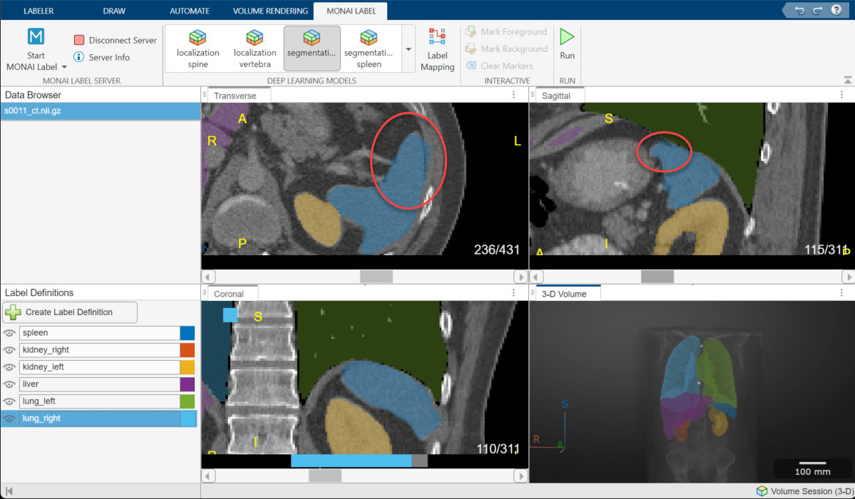 Medical Image Labeler window showing red circles that indicate areas of the spleen label that need refinement.