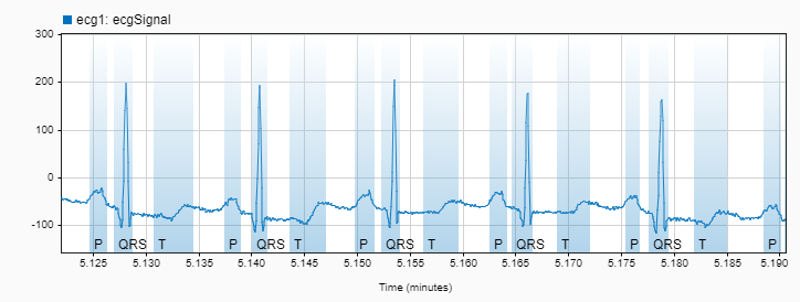 Labeled signal with "QRS" and "T" labels