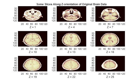 Figure contains 9 axes objects. Axes object 1 with xlabel Z = 1 contains an object of type image. Axes object 2 with title Some Slices Along Z-orientation of Original Brain Data, xlabel Z = 4 contains an object of type image. Axes object 3 with xlabel Z = 7 contains an object of type image. Axes object 4 with xlabel Z = 10 contains an object of type image. Axes object 5 with xlabel Z = 13 contains an object of type image. Axes object 6 with xlabel Z = 16 contains an object of type image. Axes object 7 with xlabel Z = 19 contains an object of type image. Axes object 8 with xlabel Z = 22 contains an object of type image. Axes object 9 with xlabel Z = 25 contains an object of type image.
