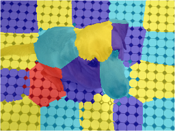 Label overlay with four high-contrast colors that improve the clarity of region boundaries.